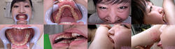 [附贈視頻] Himari Ogawa 的牙齒和咬合系列 1-2 一起 DL
