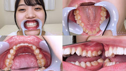 [Tooth Fetish] I observed the teeth of Marina Miura!