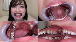 【치아 페티쉬】가미노 히나의 치아를 관찰했습니다!