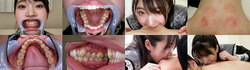 【特典動画付】皆月ひかるの歯と噛みつきシリーズ1～2まとめてDL