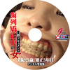 [The world foregoing release] woman amateur dental IMMA examination correction inside () digital photo album