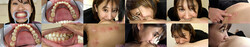 [附贈視頻] Minami Thigh&#39;s Teeth and Biting Series 1-3 Collectively DL