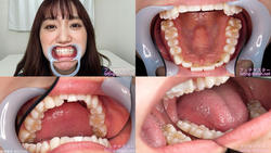 【치아 페티쉬】와카미야 호노 짱의 치아를 관찰했습니다!