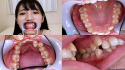 [치아 페티쉬】 카와 나 亜依 양의 치아를 관찰했습니다!