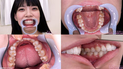 【치아 페티쉬】 하나이 시즈쿠 짱의 치아를 관찰했습니다!