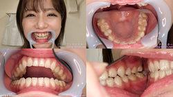 【치아 페티쉬】나가세 유이의 치아를 관찰했습니다!