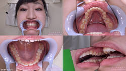 [恋牙癖] 我观察到了小川希马里的牙齿！