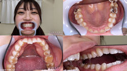 【치아 페티쉬】카사키 이치카 짱의 치아를 관찰했습니다!