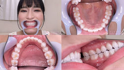 [Tooth Fetish] I observed Kayo Iwasawa&#39;s teeth!