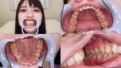 [Tooth Fetish] I observed Yuma Kouda&#39;s teeth!