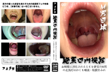 Superb view oral examination