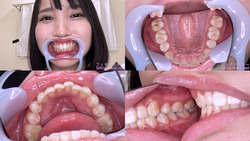 [치아 페티쉬] 枢木 아오이 짱의 치아를 관찰했습니다!