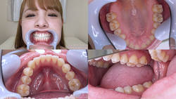 【歯フェチ】西村ニーナちゃんの歯を再び観察しました！